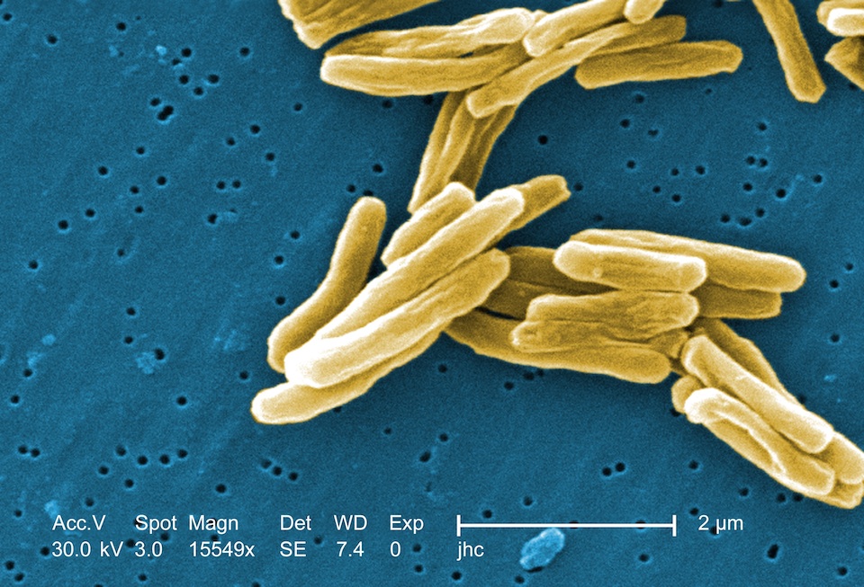 Mycobacterium, bacteria de la tuberculosis- Janice Carr, Centers for Disease Control and Prevention