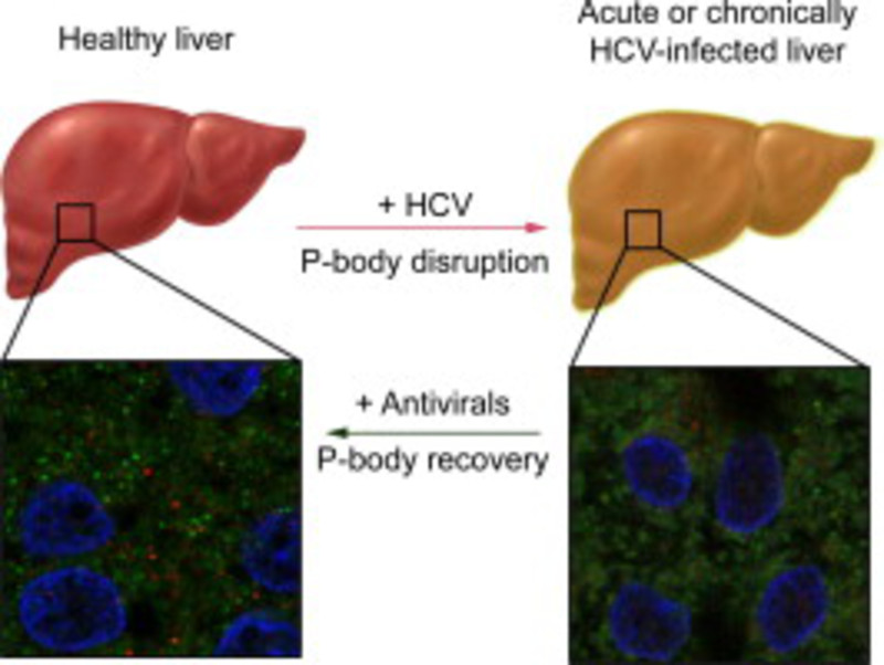 El virus de la hepatitis C altera estructuras celulares asociadas con la expresión génica