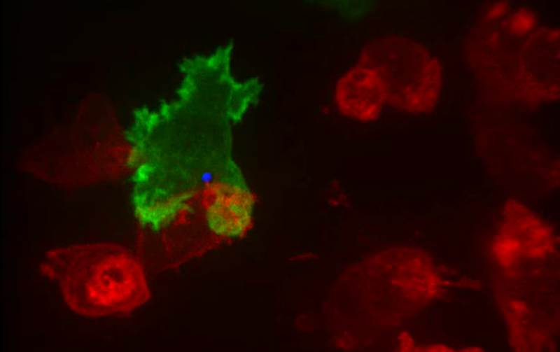 Cómo los linfocitos T atacan a las células cancerosas (VIDEO)
