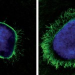 Una proteína generada por el virus del herpes potencia el crecimiento axonal