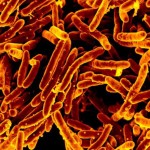 Identificado un gen para medir la susceptibilidad a la tuberculosis
