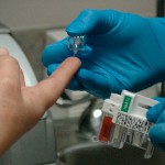 Personas con diabetes, más propensas a desarrollar tuberculosis