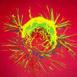 Publicado el nuevo código europeo para reducir los casos de cáncer