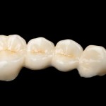 El esmalte dental podría tener su origen en las escamas de los peces