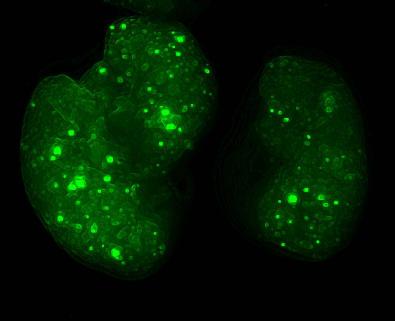 Distribución de exosomas tumorales (en verde) en pulmones de ratón durante la formación del nicho premetastásico- Héctor Peinado