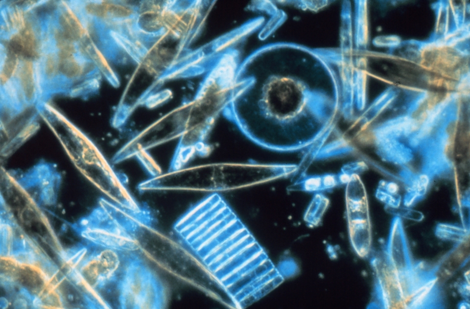 Diatomeas marinas, uno de los tipos más comunes de fitoplancton- Gordon T Taylor, Stony Brook University