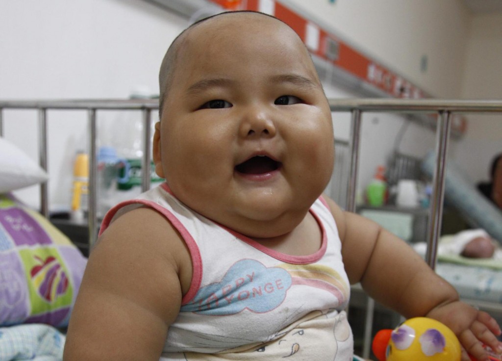 Obesidad infantil, el bebé más obeso de Colombia