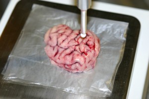 Búsqueda de tumores en el cerebro