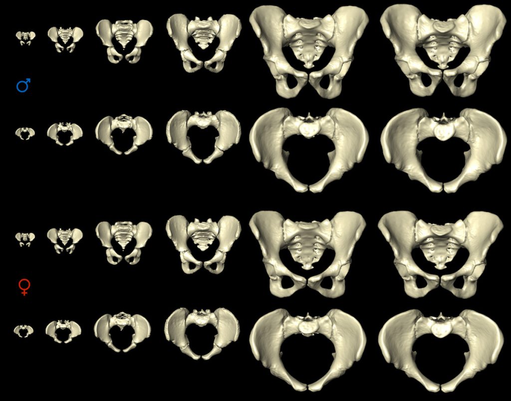 Desarrollo de la pelvis humana desde el nacimiento hasta los 80 años- MorphoLab, University of Zurich