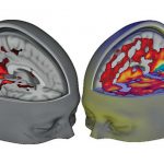 Así «actúa» el cerebro durante un «viaje» con LSD