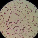 Hongos y bacterias limpian suelos contaminados con plaguicidas
