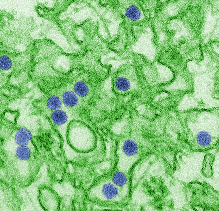 Micrografía electrónica del virus del Zika, en azul/ Wikimedia Commons