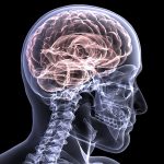 ¿Qué debemos saber sobre las lesiones cerebrales?