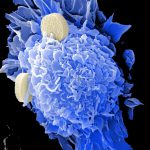 Nanovacunas contra el cáncer: Hacia la inmunización individual y personalizada