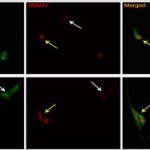 La retroalimentación entre dos genes asociados a enfermedades neurodegenerativas y cáncer