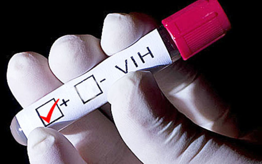 VIH análisis de sangre