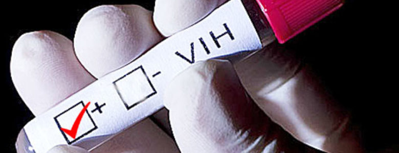 VIH análisis de sangre