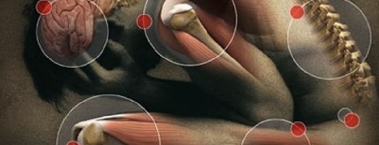Dolor crónico, Fibromialgia