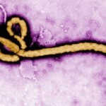 Descubren como empieza el ébola a dañar el cuerpo humano