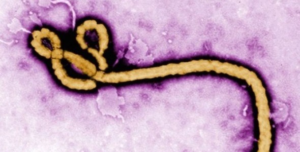 Descubren como empieza el ébola a dañar el cuerpo humano