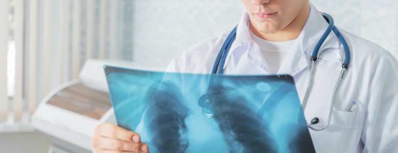 ¿Por qué la tuberculosis es resistente a los fármacos?