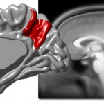 La variabilidad del precúneo del cerebro está asociada a la corteza cerebral