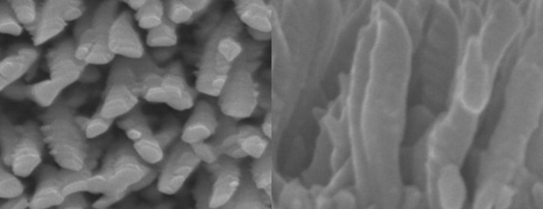 Nanoestructuras de titanio antibacterianas para implantes óseos