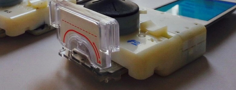 Un accesorio de smartphone te dice si tienes el VIH o la sífilis en quince minutos Un accesorio de smartphone te dice si tienes el VIH o la sífilis en quince minutos
