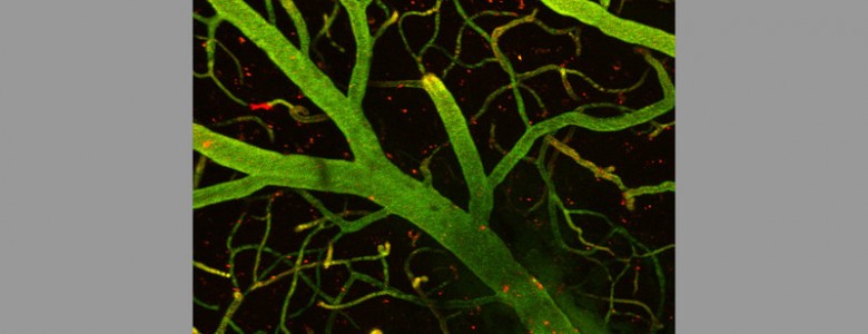 Una ambulancia que hace llegar los fármacos al cerebro