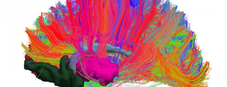 Identifican alteraciones en el sistema de recompensa cerebral de las personas con obesidad