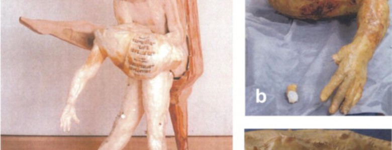 Tratamientos ‘anti-edad’ para obras de arte contemporáneo