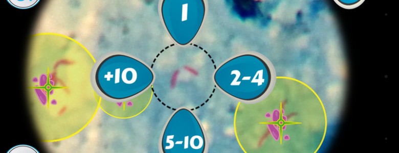 Un juego ‘online’ ayuda a diagnosticar la tuberculosis