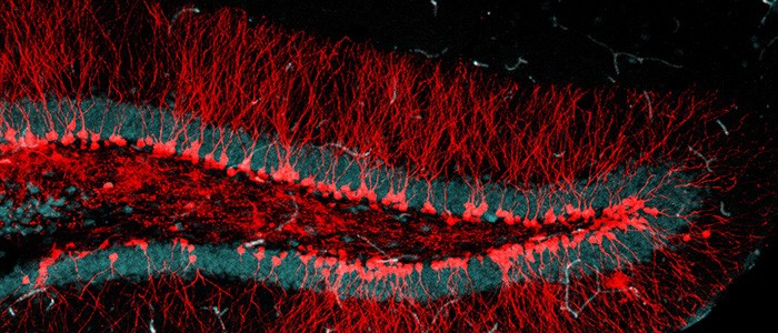 Neuronas nuevas