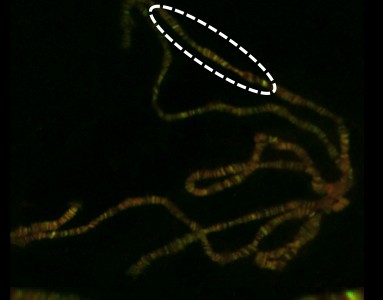 Descubierta una función inesperada para una proteína vinculada a enfermedades neurodegenerativas