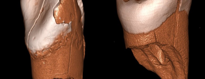 Dos dientes de 41.000 años de edad revelan la llegada de los humanos modernos a Europa