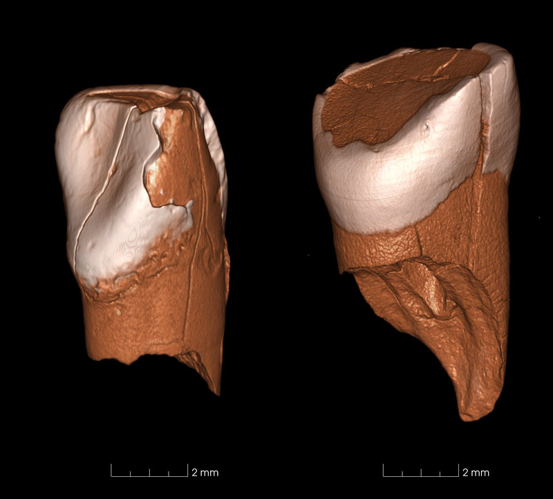 Dos dientes de 41.000 años de edad revelan la llegada de los humanos modernos a Europa