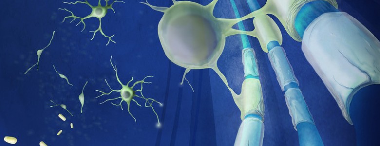 Dos fármacos cutáneos regeneran neuronas dañadas por esclerosis múltiple