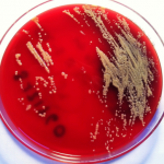 Por primera vez se presentan casos de infección por ‘Janibacter terrae’ en humanos