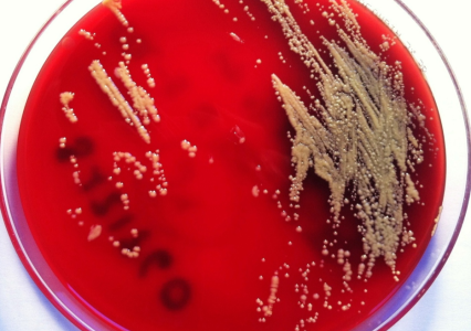 Por primera vez se presentan casos de infección por ‘Janibacter terrae’ en humanos