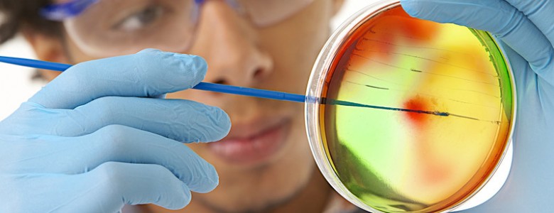 Recompensa millonaria a quien derrote a las bacterias superresistentes Recompensa millonaria a quien derrote a las bacterias superresistentes