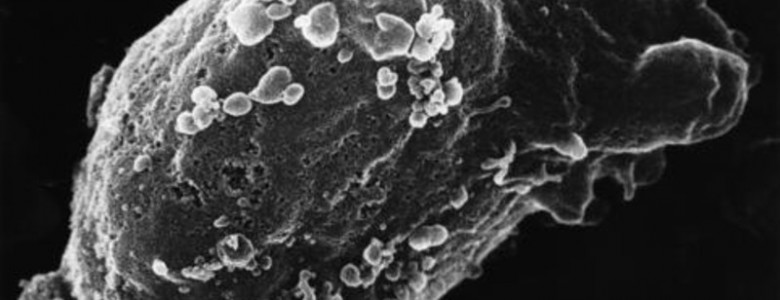 El VIH utiliza células del sistema inmunitario como ‘caballo de Troya’ para propagar la infección