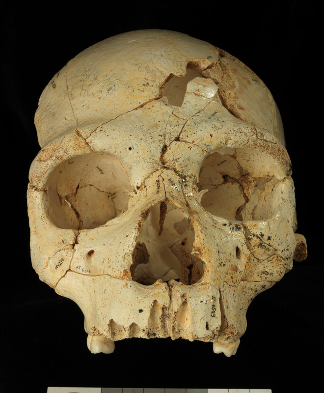 El primer caso documentado de asesinato, ocurrió hace 430,000 años
