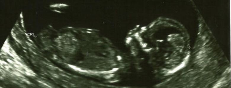 La exposición del feto a contaminantes ambientales afecta la fertilidad durante generaciones