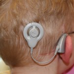 Los implantes cocleares en edad temprana mejoran la comprensión lectora de los niños