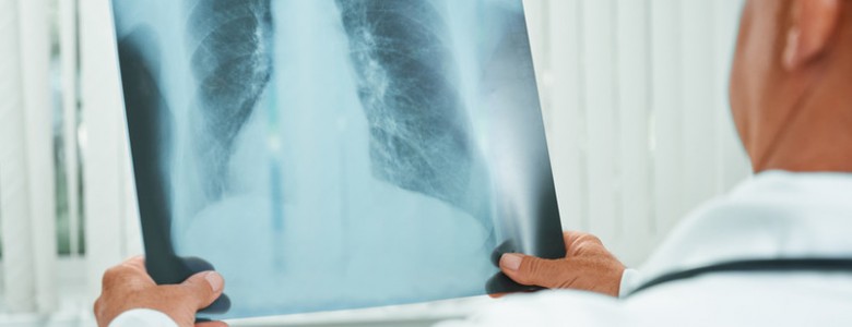 Los diez tipos de cáncer más mortíferos