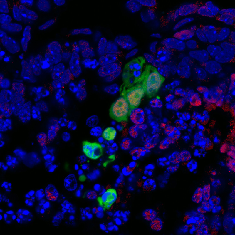 Un nuevo tipo de células madre para desarrollar órganos de reemplazo
