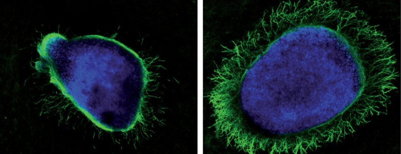 Una proteína generada por el virus del herpes potencia el crecimiento axonal Una proteína generada por el virus del herpes potencia el crecimiento axonal
