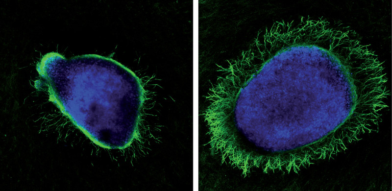 Una proteína generada por el virus del herpes potencia el crecimiento axonal