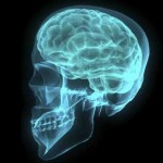 Análisis en línea gratuito de resonancia magnética del cerebro