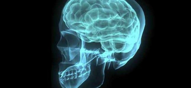 Análisis en línea gratuito de resonancia magnética del cerebro Análisis en línea gratuito de resonancia magnética del cerebro